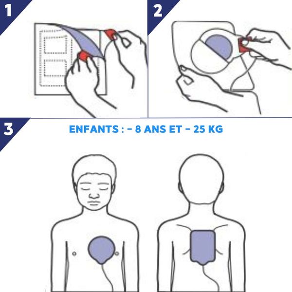 Électrode défibrillateur enfant Pedi Padz II AED Plus Zoll